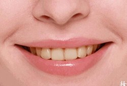 美白牙贴对牙齿有害吗（美白牙贴会伤害到牙齿吗）